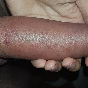 Pump Penis Galeriebild