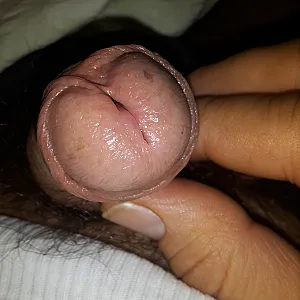 closeups gallery image