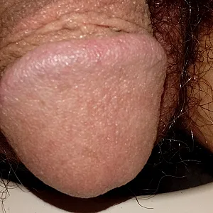Kurz vor der Rasur Galeriebild
