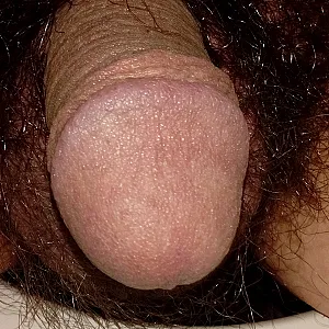 Kurz vor der Rasur Galeriebild