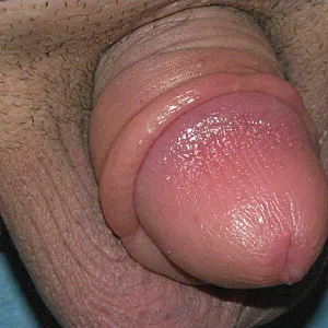 pumped dick gallery image
