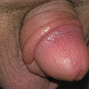 pumped dick gallery image