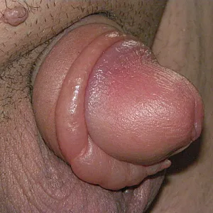 pumped dick gallery image