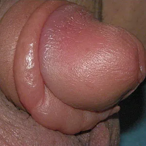 pumped dick gallery image