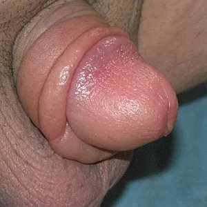 pumped dick gallery image