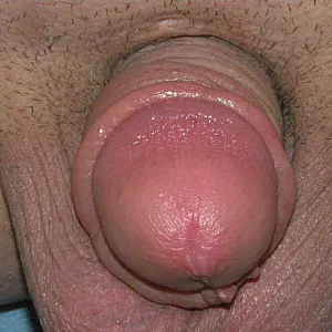pumped dick gallery image