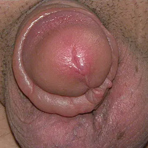 pumped dick gallery image