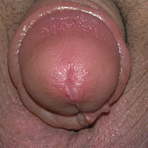 pumped dick gallery image