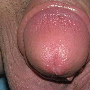 pumped dick gallery image
