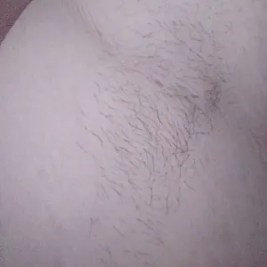 hairy gallery image