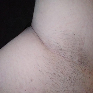 hairy gallery image