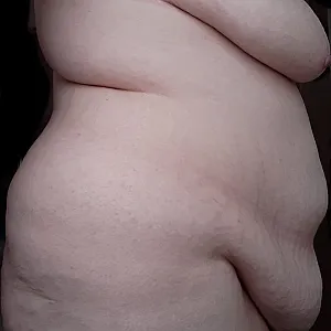 Belly gallery image