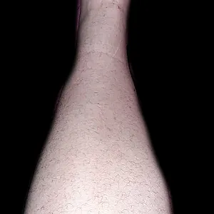 hairy legs gallery image
