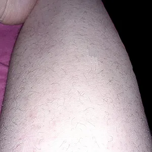 hairy legs gallery image