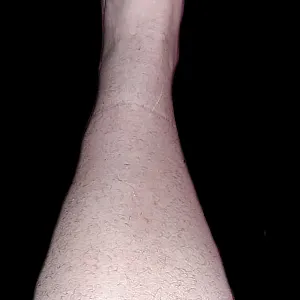 hairy legs gallery image