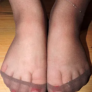 my holes gallery image