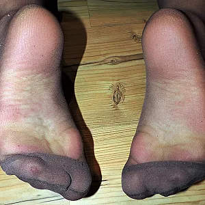 my holes gallery image