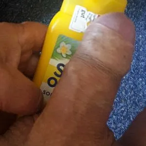 Er passt in alle drei Löcher - nah dran Galeriebild