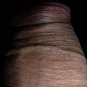 my cock gallery image