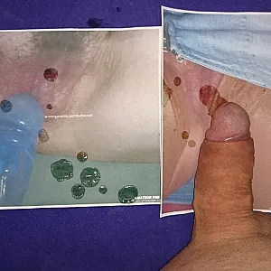 for you gallery image