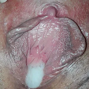 closeups gallery image