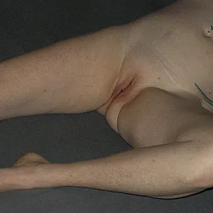 nude gallery image