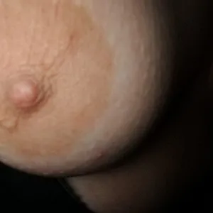 Meine Nippel Galeriebild