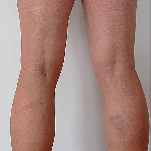 ass and legs gallery image
