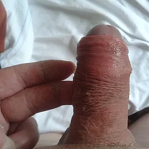 my dick gallery image