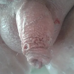 my dick gallery image
