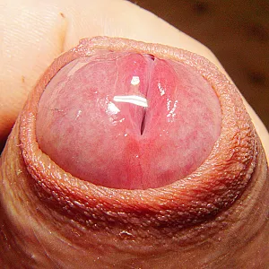 Wet glans gallery image