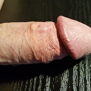 my dick gallery image