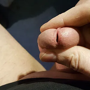 my dick gallery image