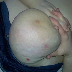 tits gallery image