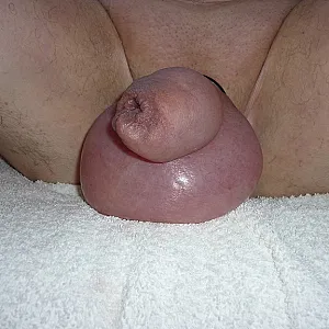 Hängesack und Vorhautdehnung Galeriebild