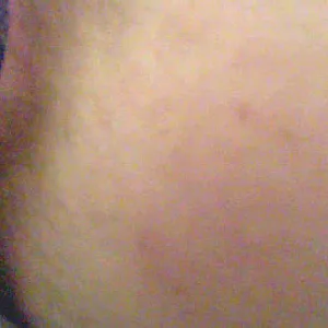 xxx gallery image