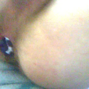 xxx gallery image