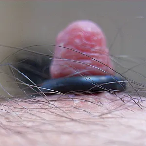 Männerbrust Galeriebild