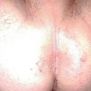 i were horny again gallery image