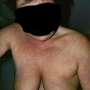 Breasts gallery image