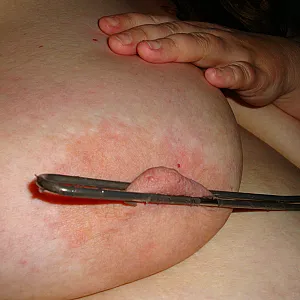 Treating tits part 1 gallery image