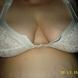 Magic Bra gallery image