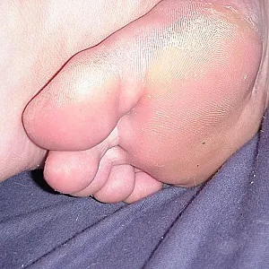 Füße meiner Schwester Galeriebild