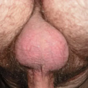 mal mit / mal ohne Galeriebild