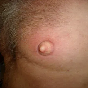 suction horny gallery image