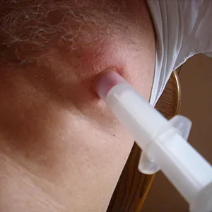 suction horny gallery image