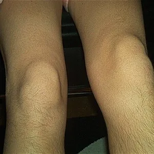 my stinky feets gallery image