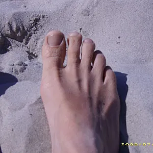 my stinky feets gallery image