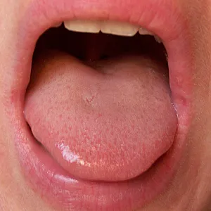 her holes gallery image