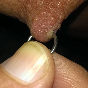 My new piercing gallery image